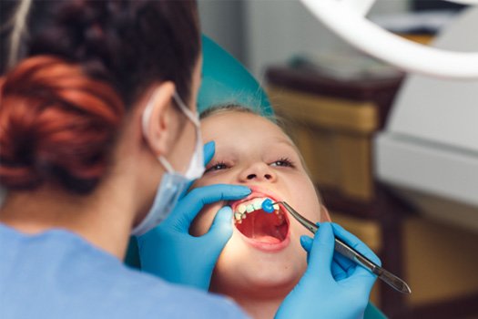 Protect your child’s smile with fluoride treatment near Big Spring