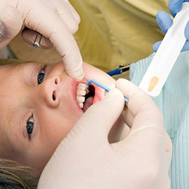 Child receiving fluoride treatment