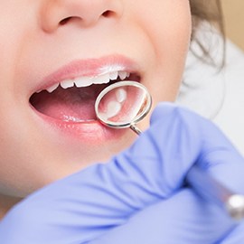 Closeup of child receiving dental care