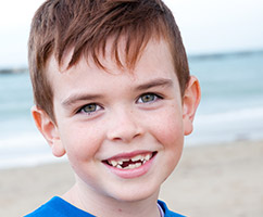 Smiling boy with some missing teeth