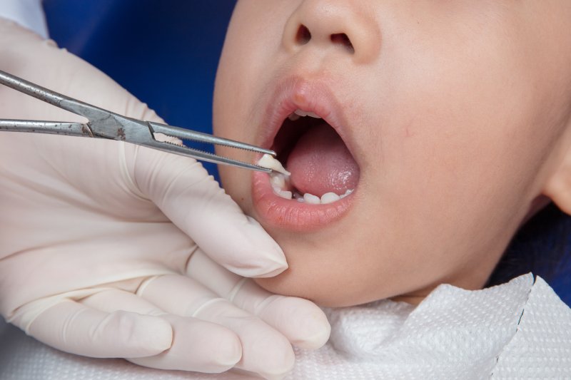 Baby tooth extraction in Midland
