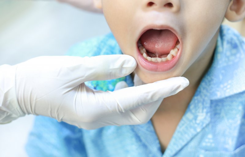 Dentist looking at a child's lip tie