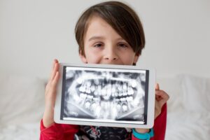 Child holding up his X-ray images